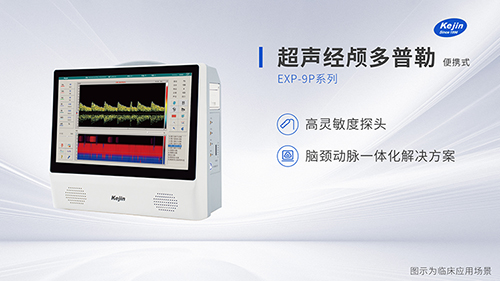 國產(chǎn)超聲經(jīng)顱多普勒廠家
